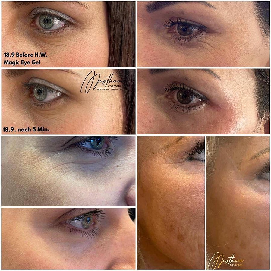 Magic Eye Lifting-Gel
